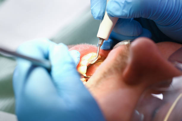 Best Emergency Treatment for Oral Infections in Eldorado, IL